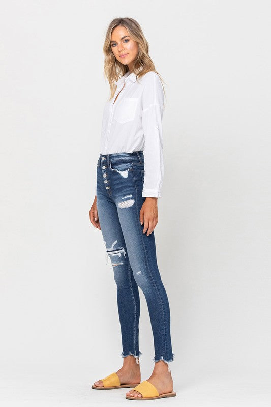 Denim - High Rise Patched Button Up Raw Hem Ankle Skinny -  - Cultured Cloths Apparel