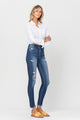 Denim - High Rise Patched Button Up Raw Hem Ankle Skinny -  - Cultured Cloths Apparel